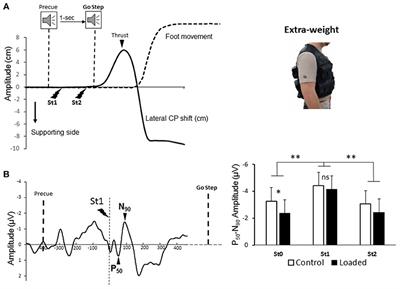 Supplementary Motor Area and Superior Parietal Lobule Restore Sensory Facilitation Prior to Stepping When a Decrease of Afferent Inputs Occurs